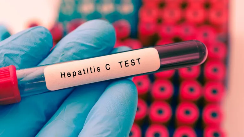 Hepatitis Screening Made Mandatory for All Health Ministry Employees and People Above 12